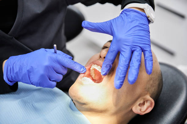 Best Emergency Care for Gum Disease in Palestine, TX